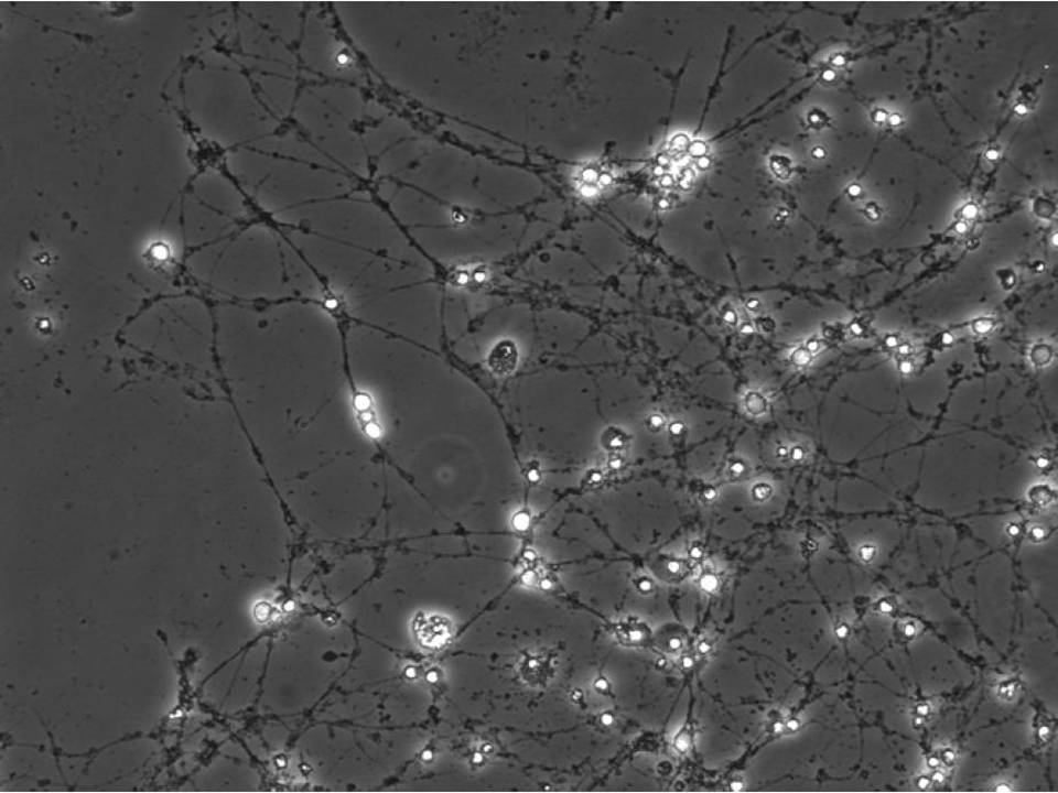 Primary Rat Neurons in Adherence - 48 hrs post EP - Viability 100 per cent